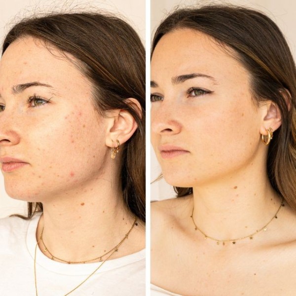 Sérum anti-imperfections Bio Endro cosmétiques
